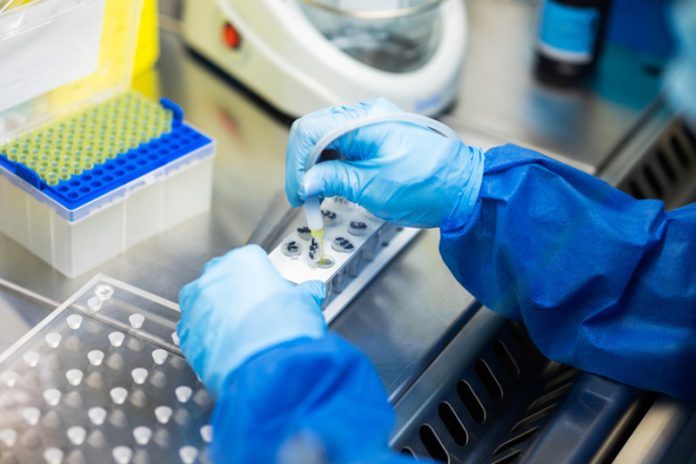 laboratory test