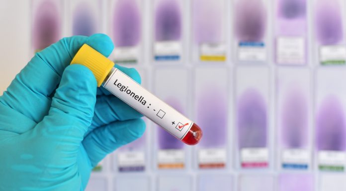 Legionella