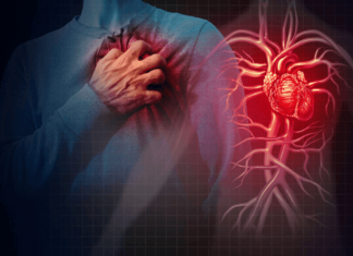 Heart attack