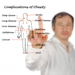 Obesity Complications: Excess of Anything Is Bad obesity
