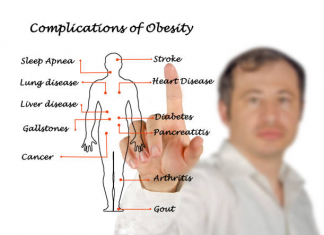 Obesity Complications: Excess of Anything Is Bad obesity
