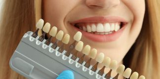 Porcelain Lamina Veneers