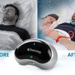 Anti-snoring Device