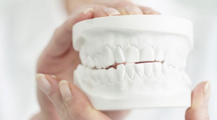 Invisalign: Experiences After Two Months Invisalign