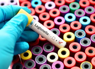 Is There a Risk of Legionnaires’ Disease in Resorts? legionnaires
