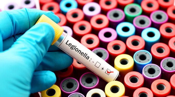 Is There a Risk of Legionnaires’ Disease in Resorts? legionnaires