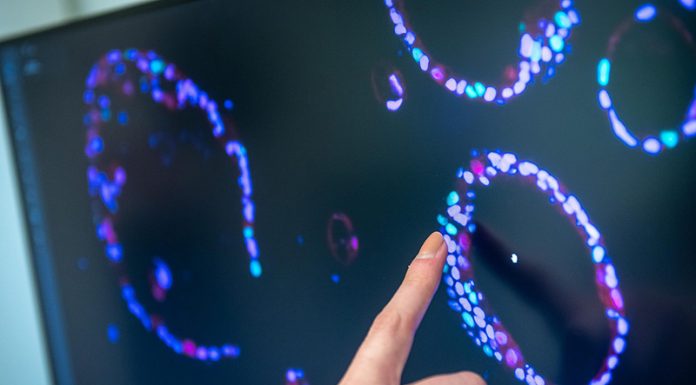 A Review: AI and Computer Vision in Ovarian Cancer Detection (2023) AI and Computer Vision in Ovarian Cancer Detection