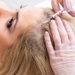 PRP Hair Treatment