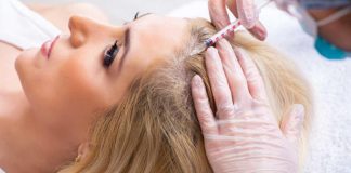 PRP Hair Treatment