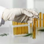 How Long is CBD Detectable in Urine