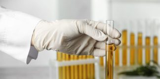 How Long is CBD Detectable in Urine? Detection Timelines, Legality, and Testing Methods How Long is CBD Detectable in Urine