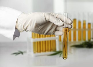 How Long is CBD Detectable in Urine