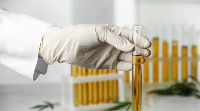 How Long is CBD Detectable in Urine