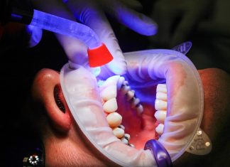 Dentist, Facet and Uv light