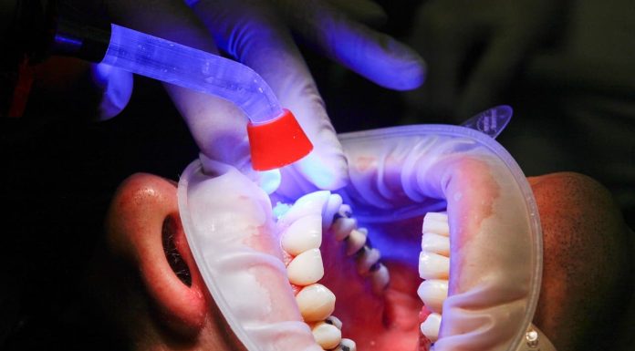 Dentist, Facet and Uv light
