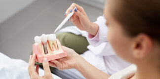 The Complete Guide to Dental Implants: What You Need to Know Dental Implants