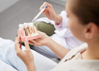 Dental Implants