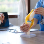 Female doctor who is explaining the treatment method of the knee joint to the woman patient