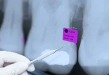 What Dentistry’s AI Revolution Teaches Other Industries What Dentistry’s AI Revolution Teaches Other Industries