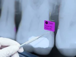 What Dentistry’s AI Revolution Teaches Other Industries