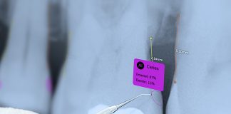 What Dentistry’s AI Revolution Teaches Other Industries