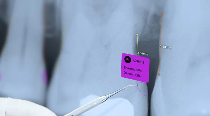 What Dentistry’s AI Revolution Teaches Other Industries What Dentistry’s AI Revolution Teaches Other Industries