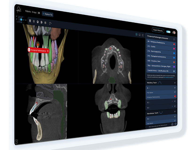What Dentistry’s AI Revolution Teaches Other Industries