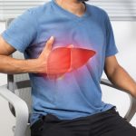 Person with Hemochromatosis