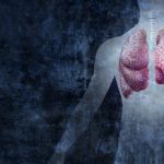 Mesothelioma Is Linked to Asbestos Exposure