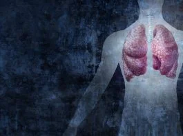 Mesothelioma Is Linked to Asbestos Exposure