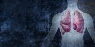 Mesothelioma Is Linked to Asbestos Exposure