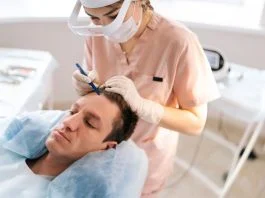 Hair Transplant Clinic - balding male patient