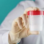 At Home Sperm Test - sperm sample