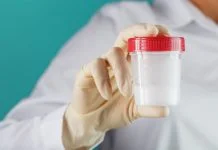 At Home Sperm Test - sperm sample