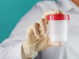 At Home Sperm Tests: What Every Man Should Know About Male Fertility Screening At Home Sperm Test - sperm sample