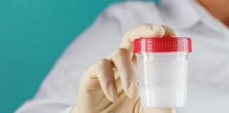 At Home Sperm Test - sperm sample
