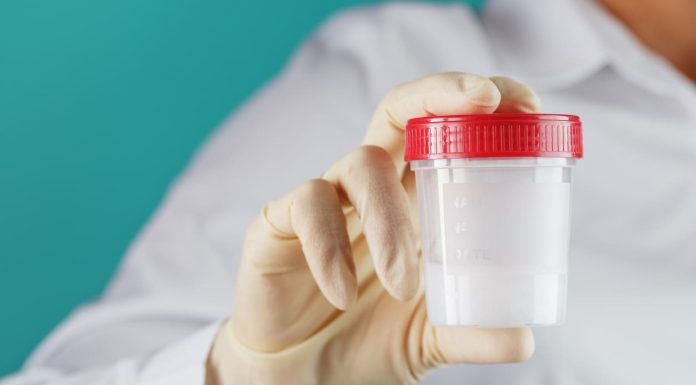 At Home Sperm Tests: What Every Man Should Know About Male Fertility Screening At Home Sperm Test - sperm sample