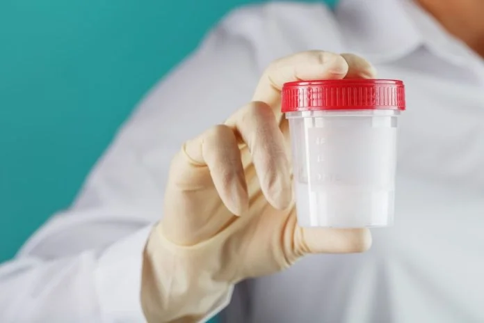 At Home Sperm Test - sperm sample