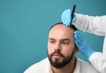 Top 10 Clinics with the Best Before-and-After Hair Transplant Results — Verified by Patients Baldness problem. Doctor in medical gloves drawing marks on patient's head before hair transplant surgery