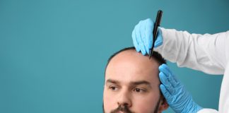Top 10 Clinics with the Best Before-and-After Hair Transplant Results — Verified by Patients Baldness problem. Doctor in medical gloves drawing marks on patient's head before hair transplant surgery