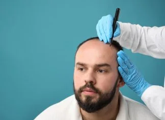 Top 10 Clinics with the Best Before-and-After Hair Transplant Results — Verified by Patients Baldness problem. Doctor in medical gloves drawing marks on patient's head before hair transplant surgery